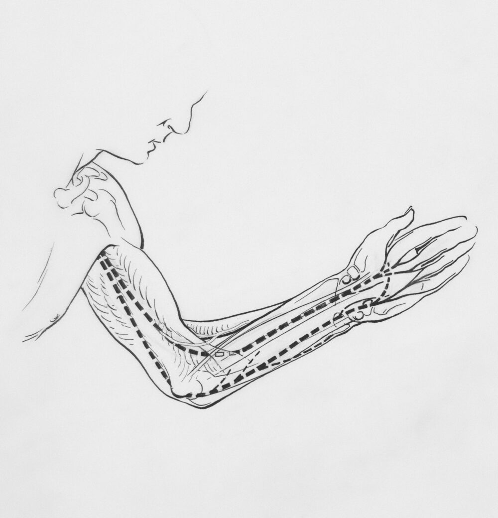 治療法